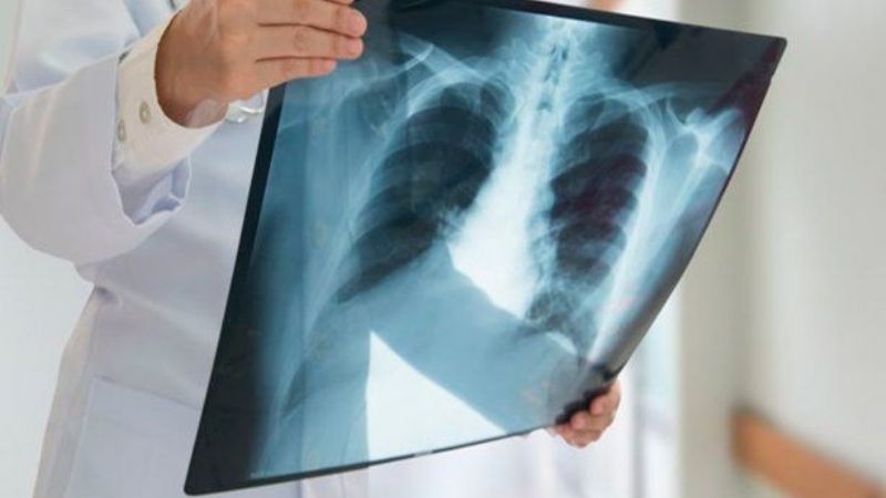 Ómicron afectaría menos a los pulmones que las otras variantes