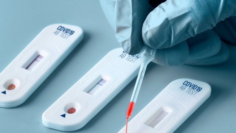 Cuándo se podrán comprar los autotest aprobados por ANMAT