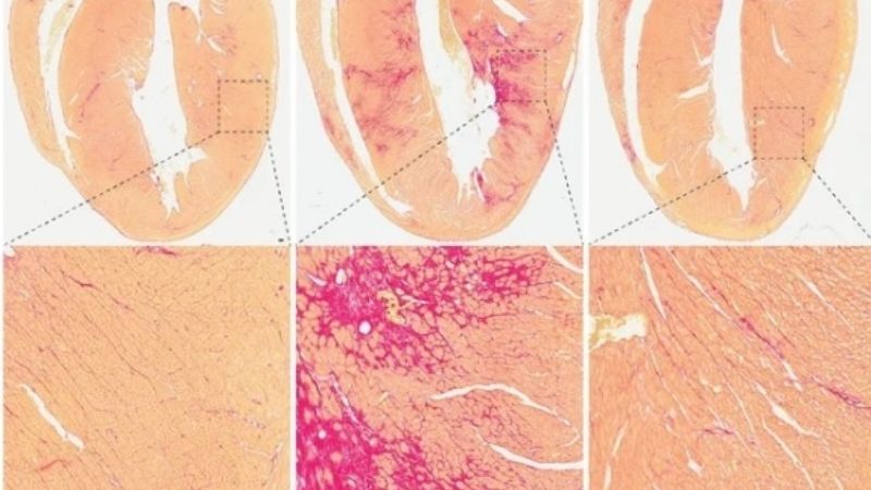 Científicos australianos comprueban como el COVID-19 daña el corazón