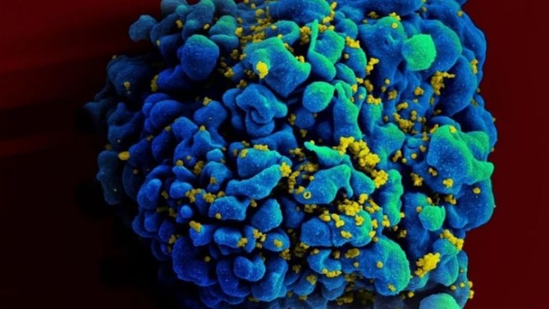 Una mujer se curó del VIH gracias a un tratamiento novedoso