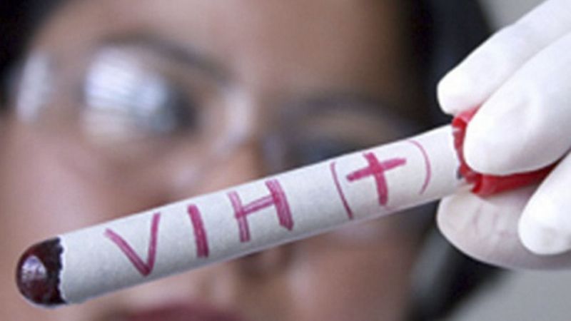 Reclaman que se apruebe la nueva ley de VIH, hepatitis, tuberculosis e ITS