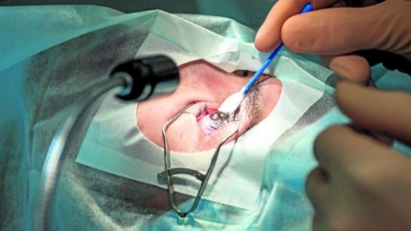 Cuarta ablación de córneas del año