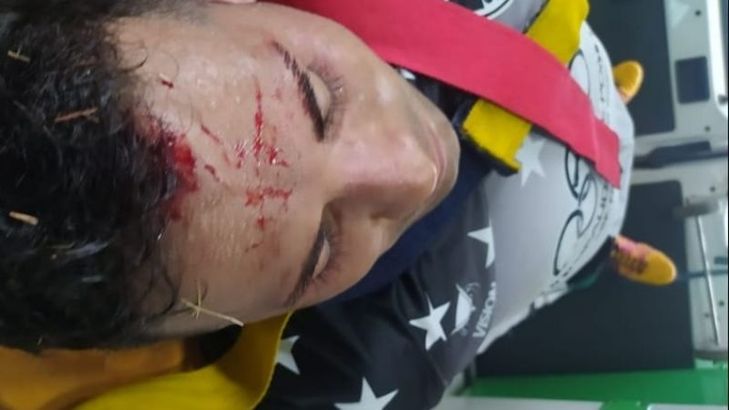 Suspenden San Martín-Newbery, por agresión a un jugador visitante