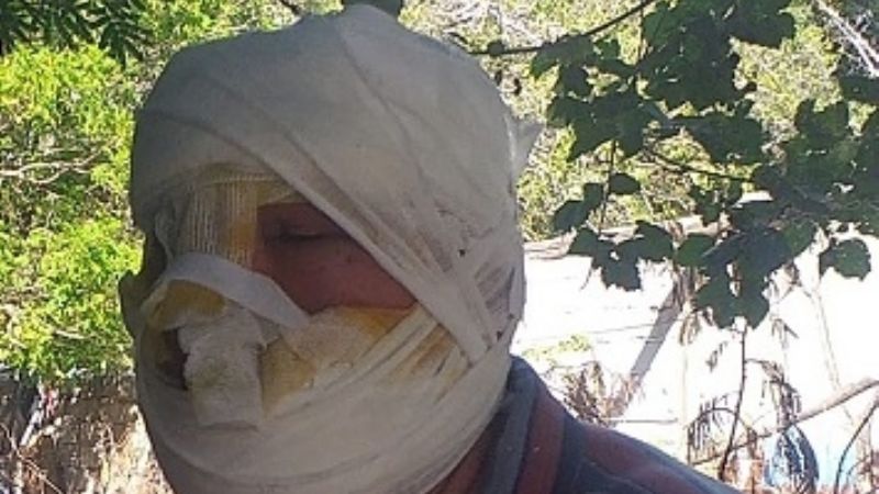 Un incendio devoró su precaria casa y necesita ayuda