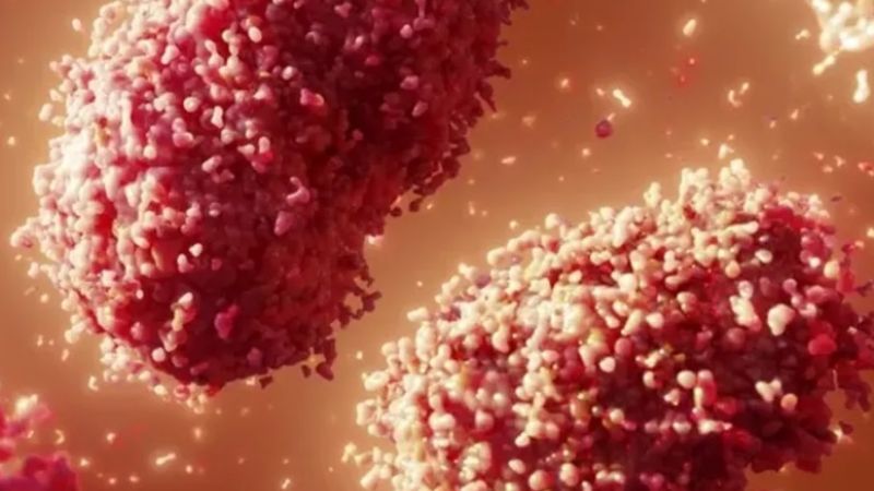 Viruela del mono: confirmaron el primer caso del virus en el país