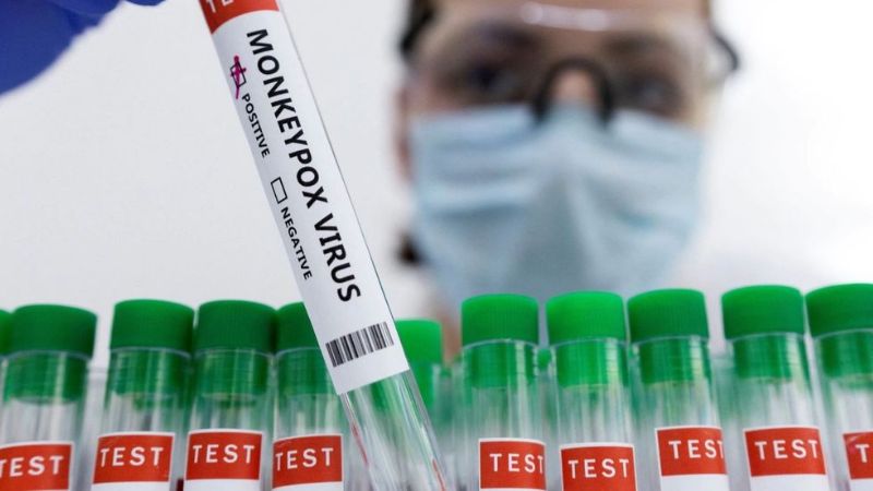Viruela del mono: la OMS hace un llamado para contener el brote