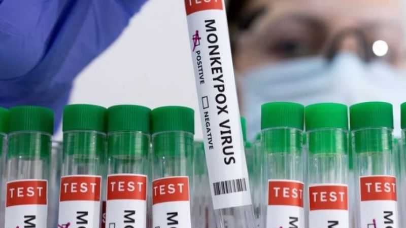 Viruela del mono: confirmaron el cuarto caso en Argentina