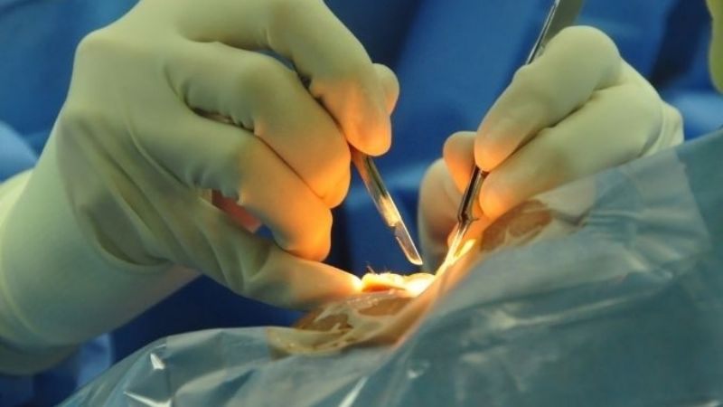 Se realizó una nueva ablación de córneas