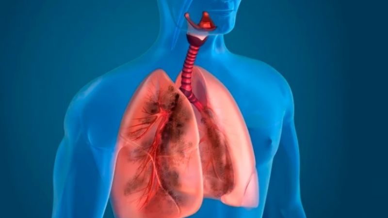 Murió otra persona por neumonía bilateral de origen desconocido