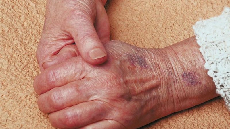 Rescatan a una mujer y a su hija con discapacidad sometidas a cautiverio