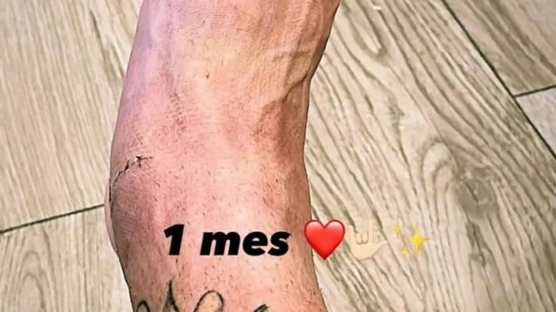 Kranevitter mostró su tobillo a un mes de la lesión