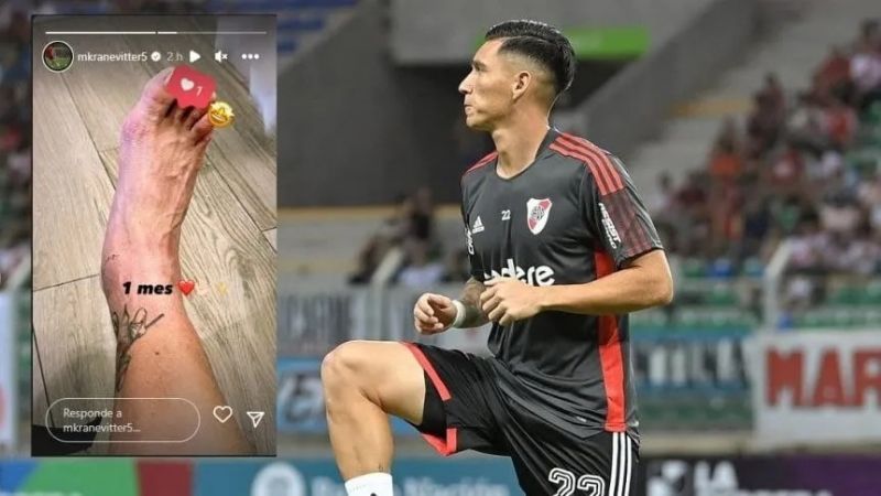 Kranevitter mostró su tobillo a un mes de la lesión