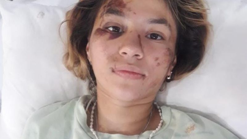 Piden ayuda para pagar la cirugía de una joven accidentada