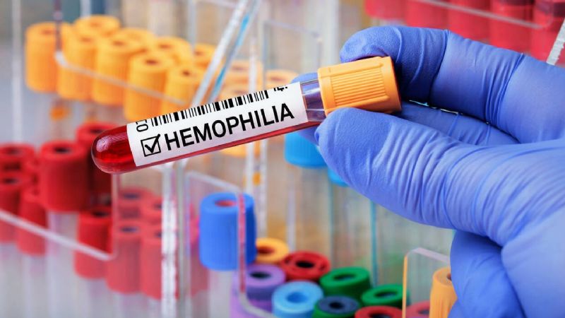 17/4 - Día Mundial de la Hemofilia: la importancia de la prevención