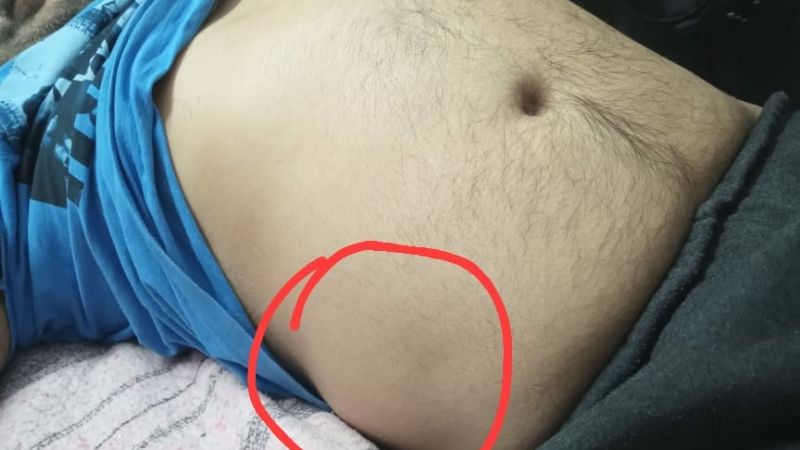 Familiares de paciente internado enfurecidos con el Ministerio de Salud