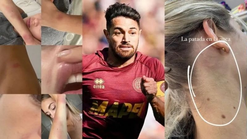 Denuncia por violencia de género a Lautaro Acosta