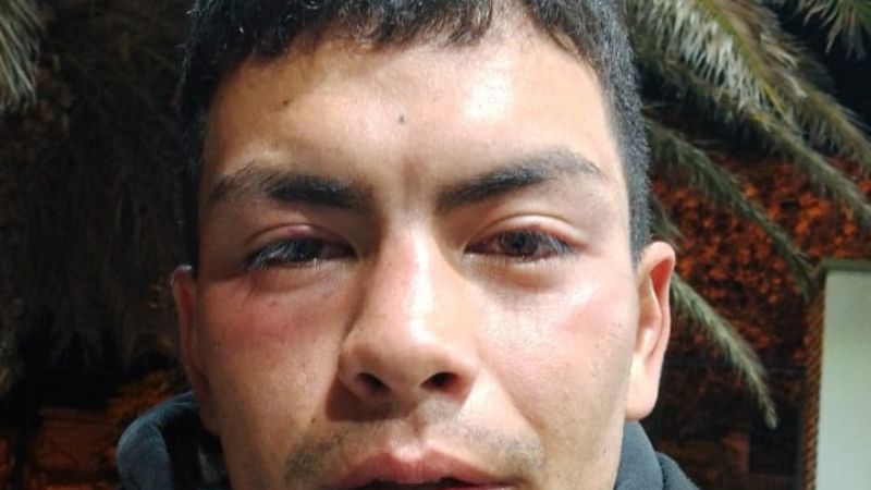 Brutal golpiza a recolectores de orina