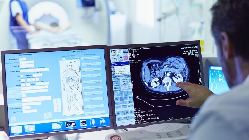 Día Mundial del Cerebro: cuidados