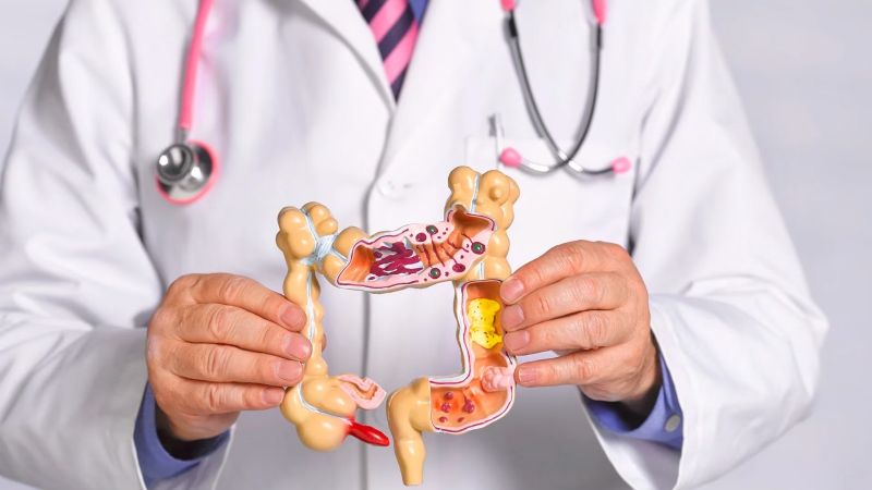Continúa la Campaña de prevención de Cáncer de Colon