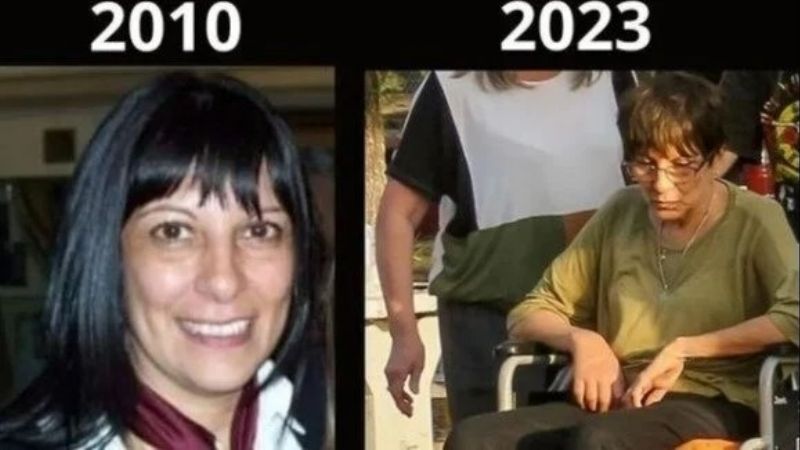 Graciela, la mujer envenenada con nafta que ahora sufre problemas de salud