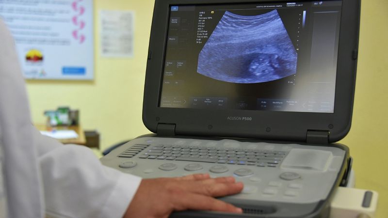 Avanza el proceso de compra de equipamiento sanitario en Catamarca