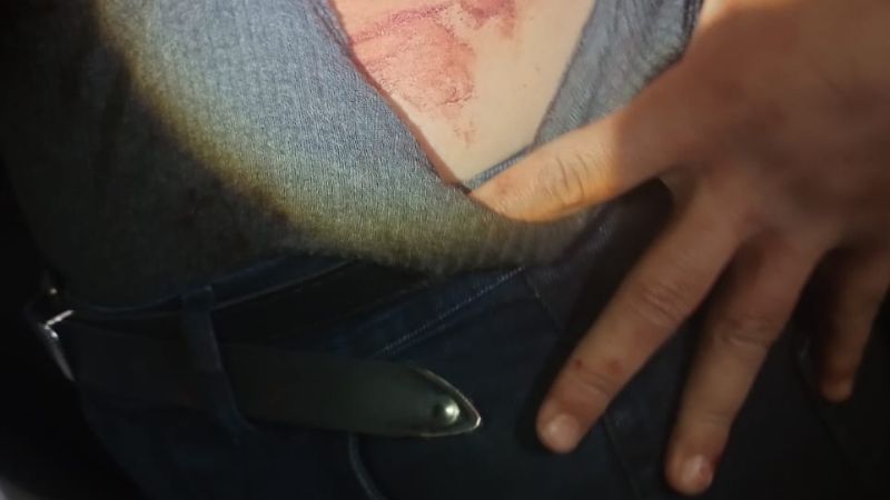 Brutal ataque a una joven de 20 años