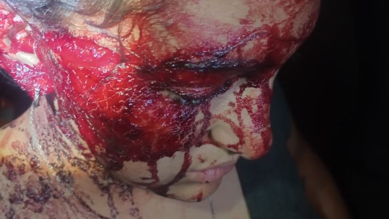 Brutal ataque a una joven de 20 años