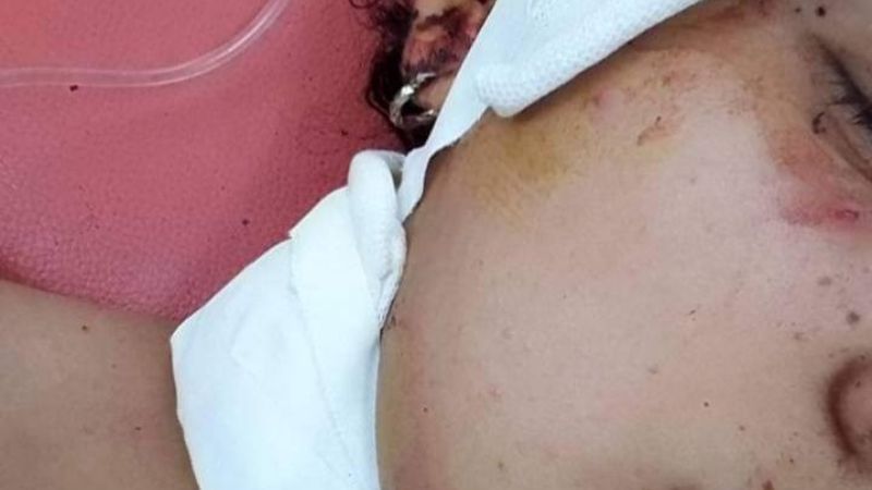 Conmovedor pedido de justicia de la joven acuchillada por su pareja