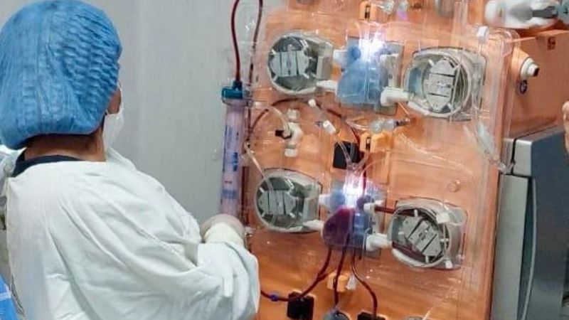 El Hospital de Niños Eva Perón revoluciona el tratamiento de pacientes críticos con Terapia Renal Continua