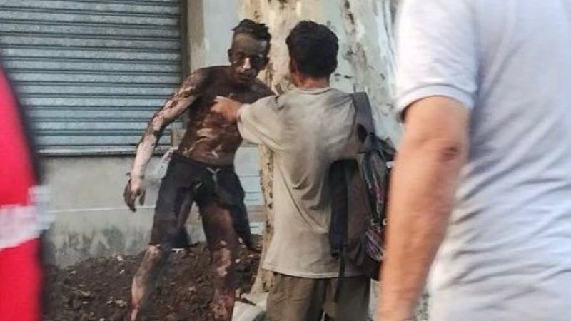 Intentó robar cables, se electrocutó y terminó con el 90% del cuerpo quemado