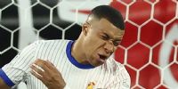 LA NARIZ de Mbappé muestra los signos de la fractura, que sufrió el astro francés.