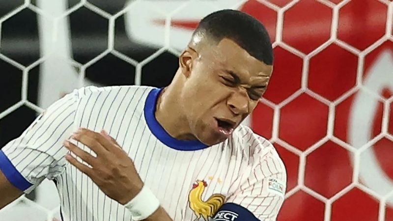 Mbappé se fracturó la nariz, pero no será operado