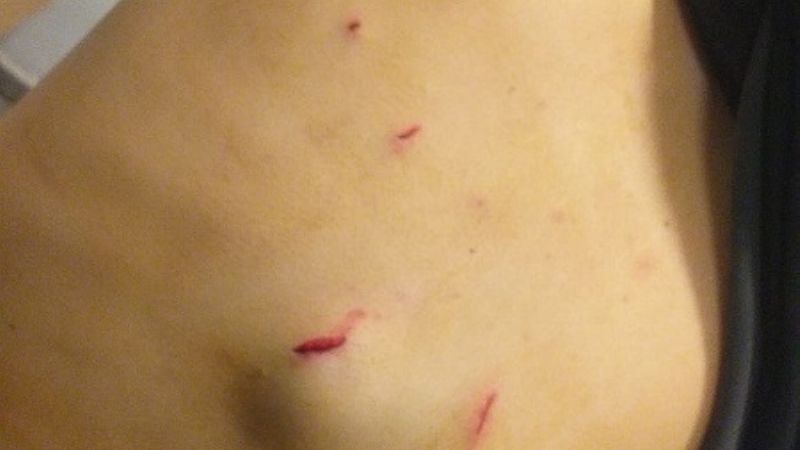 En violento intento de asalto un hombre recibió seis puntazos