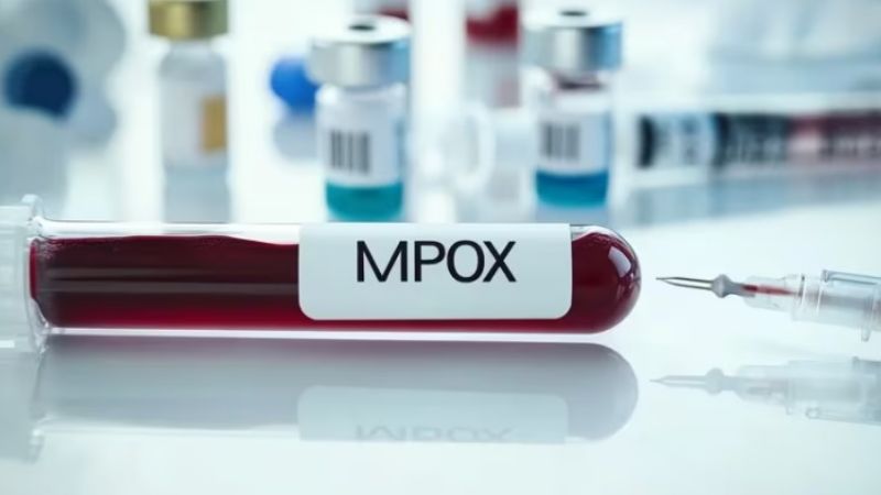 Viruela del mono: cuáles son los riesgos de una nueva pandemia