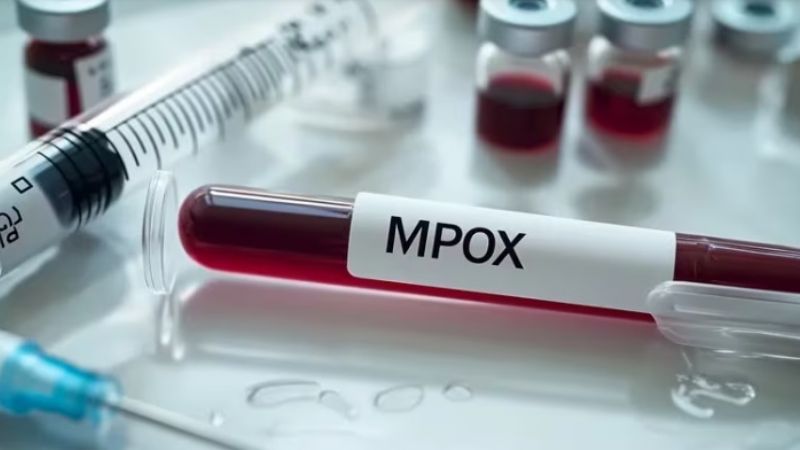 Viruela símica: cómo se contagia el virus mpox