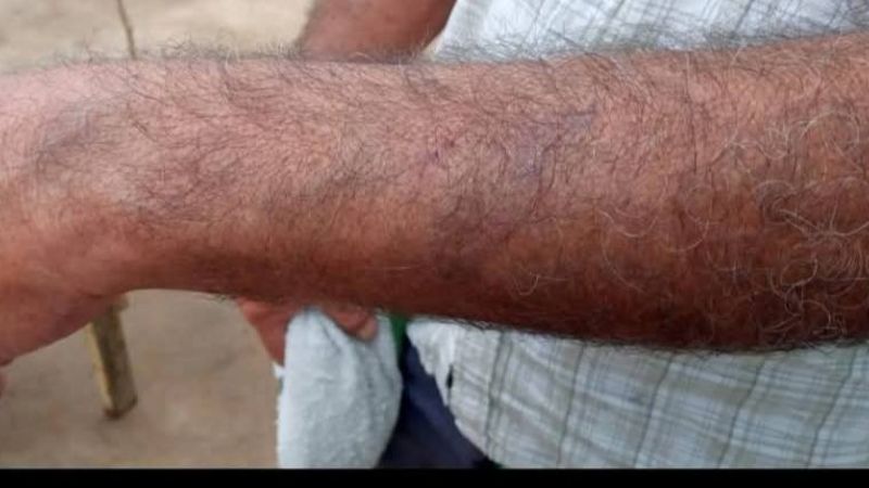 Patrón golpeó salvajemente a su empleado en un campo