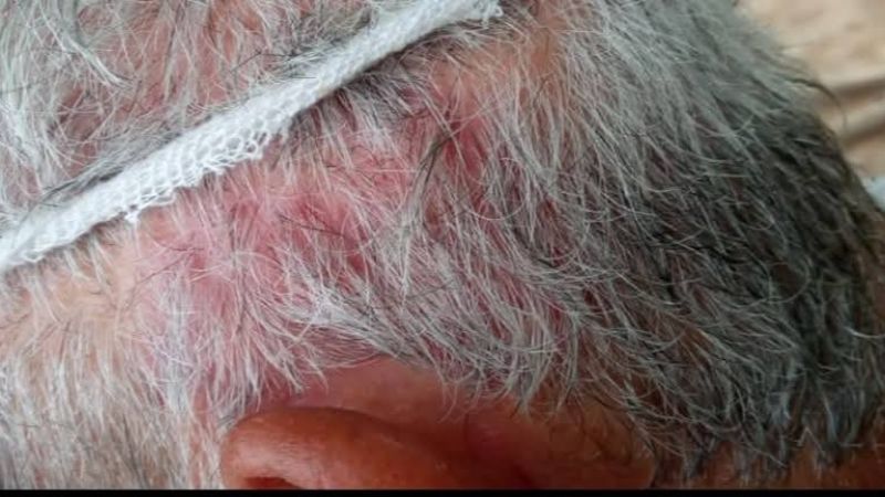 Patrón golpeó salvajemente a su empleado en un campo