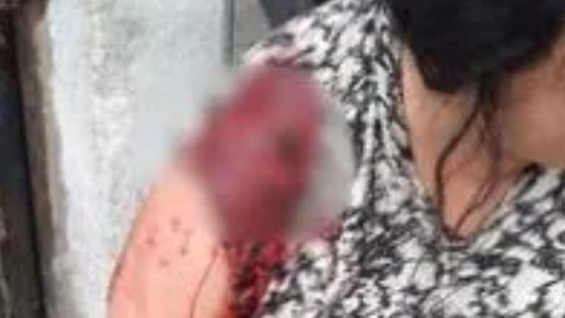 Una joven sorprendió a su mamá mientras descansaba y la atacó a puñaladas