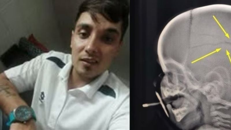 Liberaron a un condenado por violencia infantil y fracturó el cráneo de un bebé