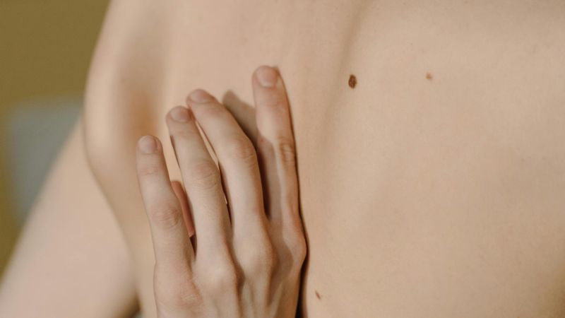 Jornada de prevención de cáncer de piel en la Plaza 25 de Mayo