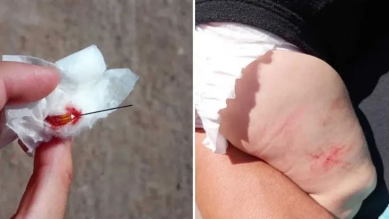 Llevó a vacunar a su bebé y denunció que le dejaron la aguja clavada en su piernita