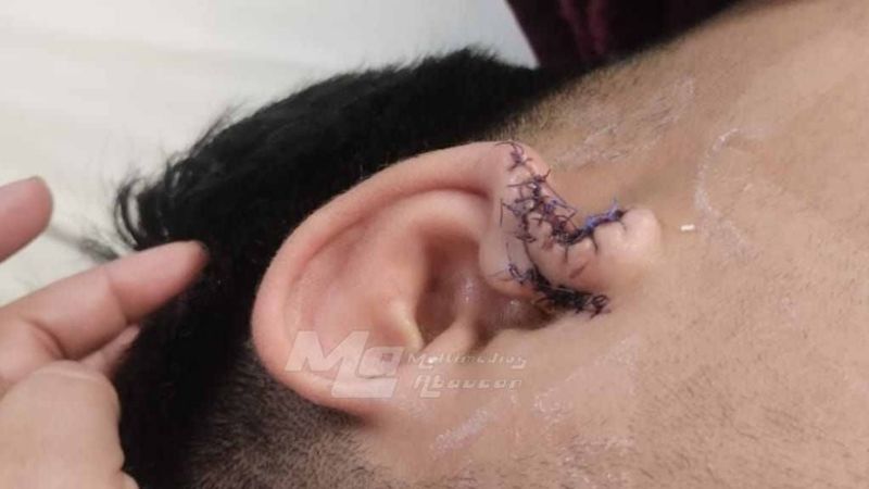 Medanitos: un joven sufrió una salvaje agresión