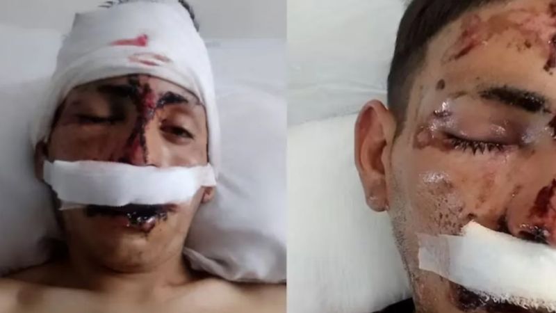 Le pidieron dinero para el vino, se negó y le desfiguraron la cara a ladrillazos y golpes