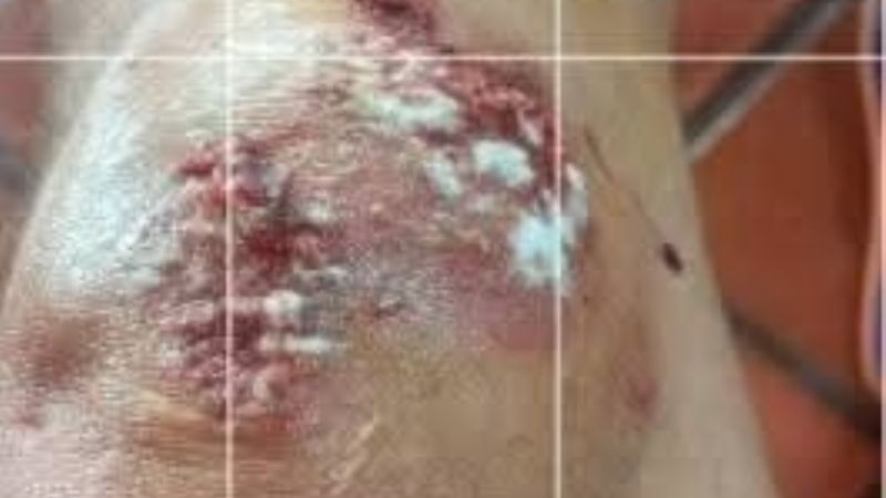 Un profesional fue gravemente atacado por un perro en El Rodeo