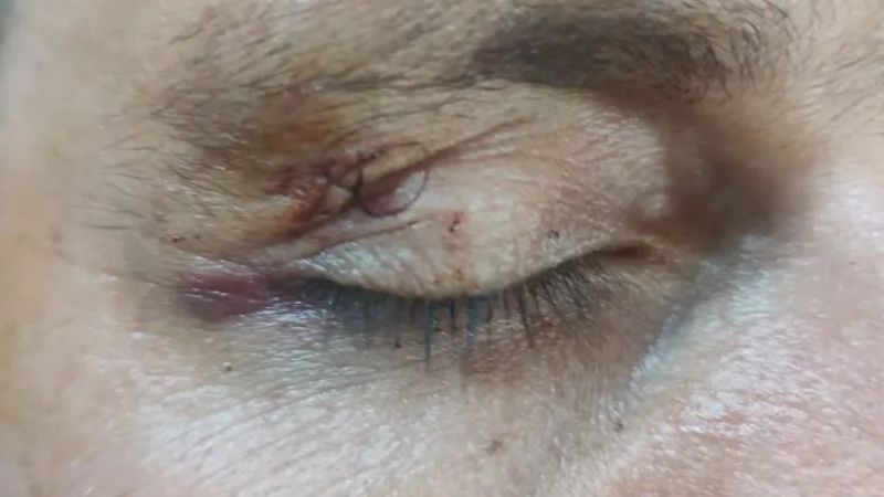 Un profesional fue gravemente atacado por un perro en El Rodeo