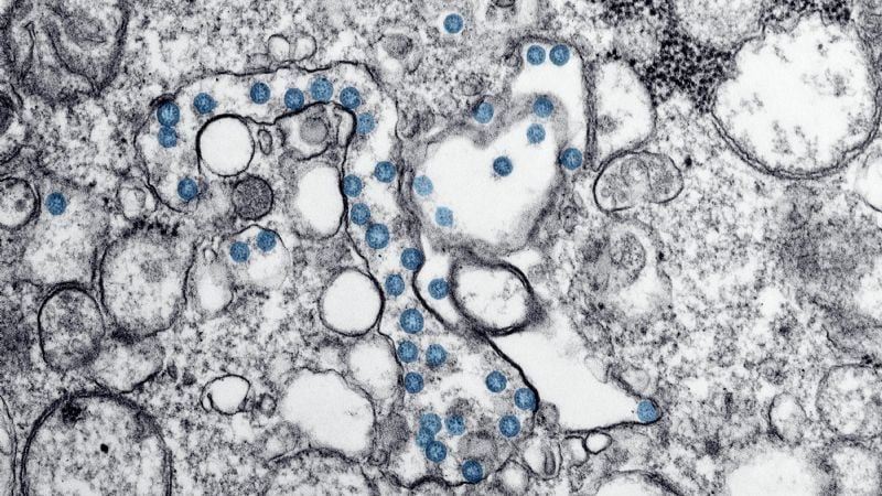 Argentina detecta el primer caso del clado Ib de viruela símica, más contagioso y grave