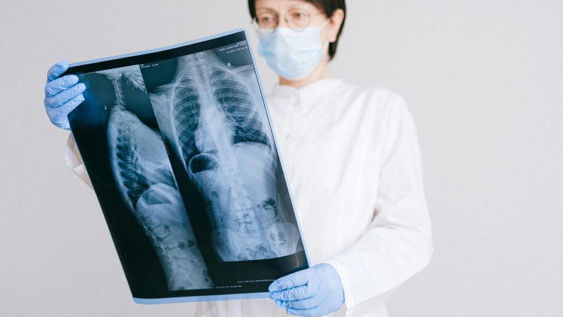 Nueva estrategia de vacunación contra el neumococo y claves para prevenir enfermedades