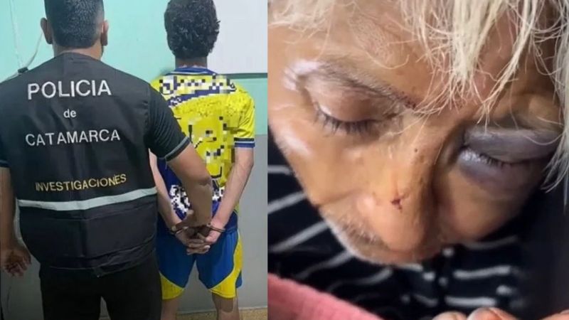 Detuvieron al presunto agresor del “Topo”, un personaje muy querido por los catamarqueños