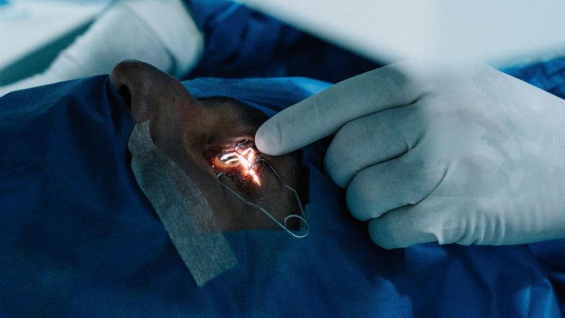 El Sanatorio Pasteur fue autorizado para realizar trasplantes de córneas