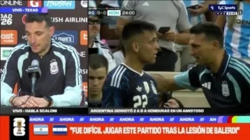 Scaloni no descarta más cambios por lesiones